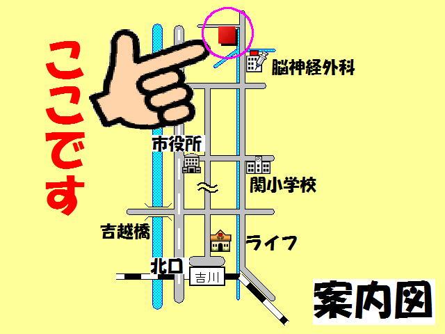 Other. map